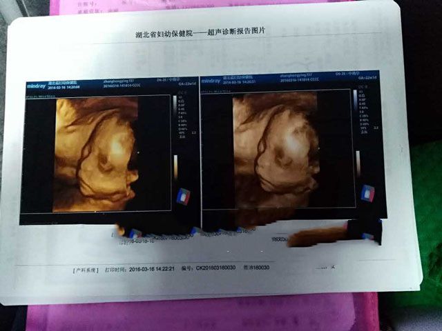 ���ݴ���